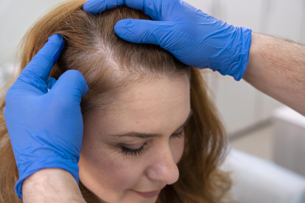 Trichology Treatment for Thin Hair