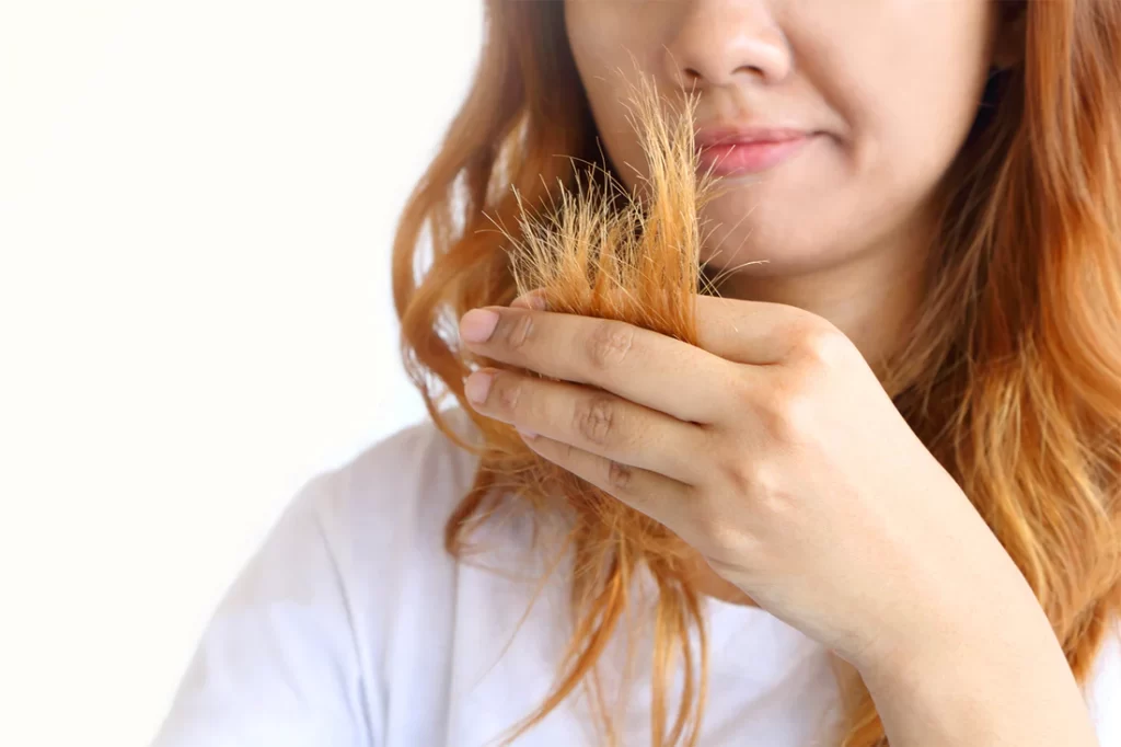 Hair Breakage